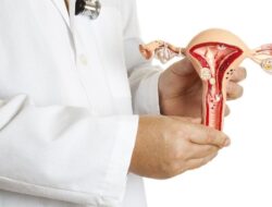 Sakit Kepala Saat Haid Datang, Awas Kemungkinan Endometriosis di Otak